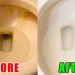 Mẹo hay tẩy bồn cầu bẩn nhanh chóng và hiệu quả